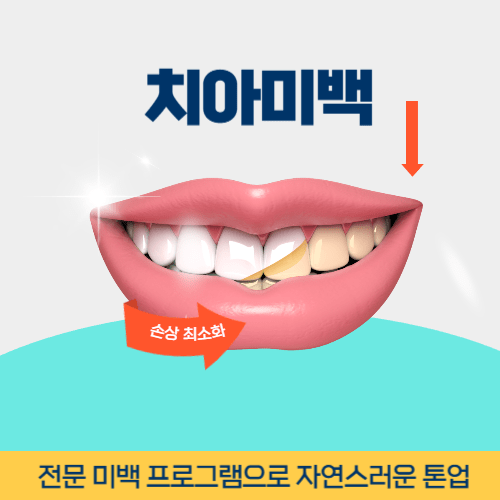 김포치과 김포시 치과 치아미백
